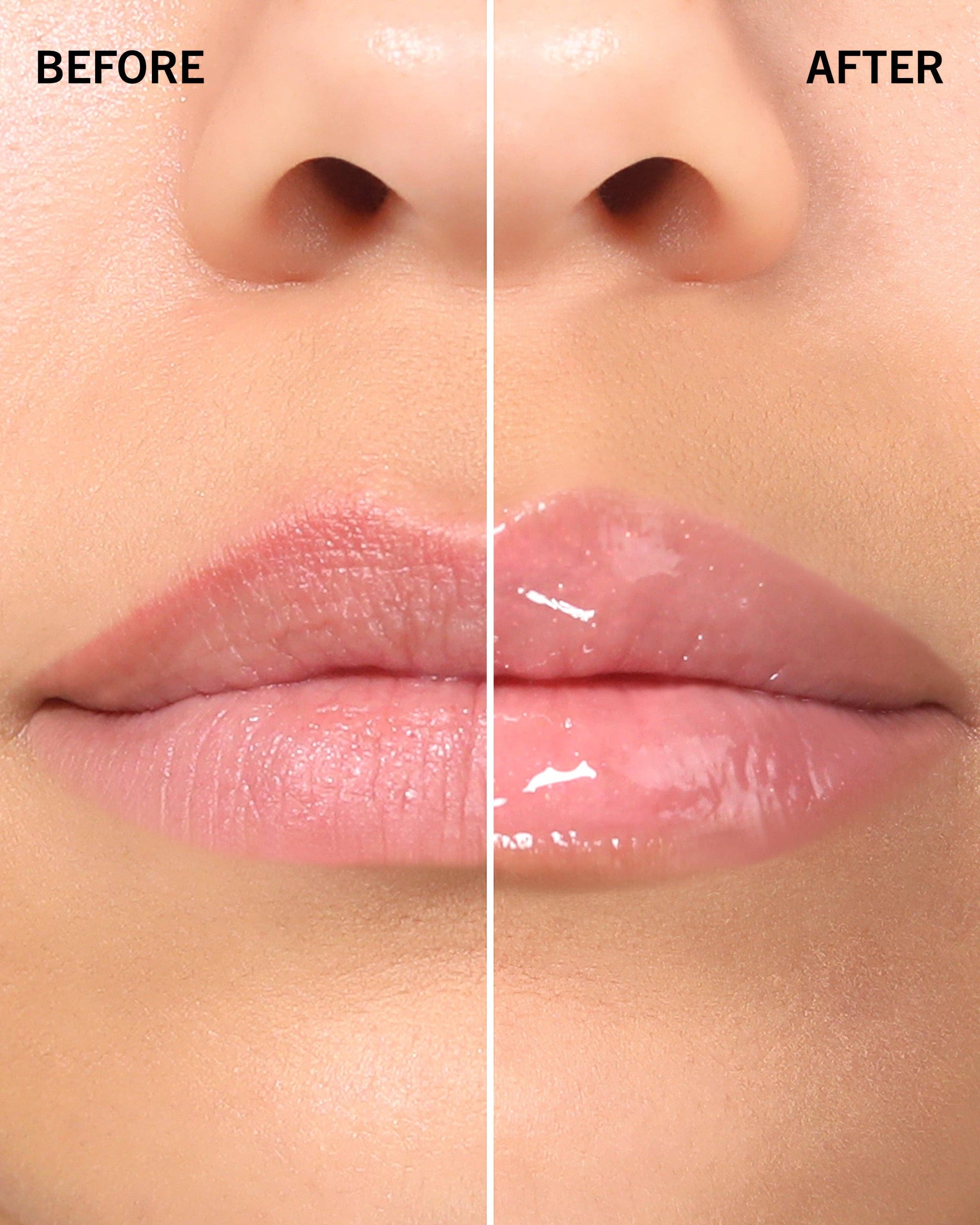 Before and after comparison of lips