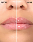 Before and after comparison of lips